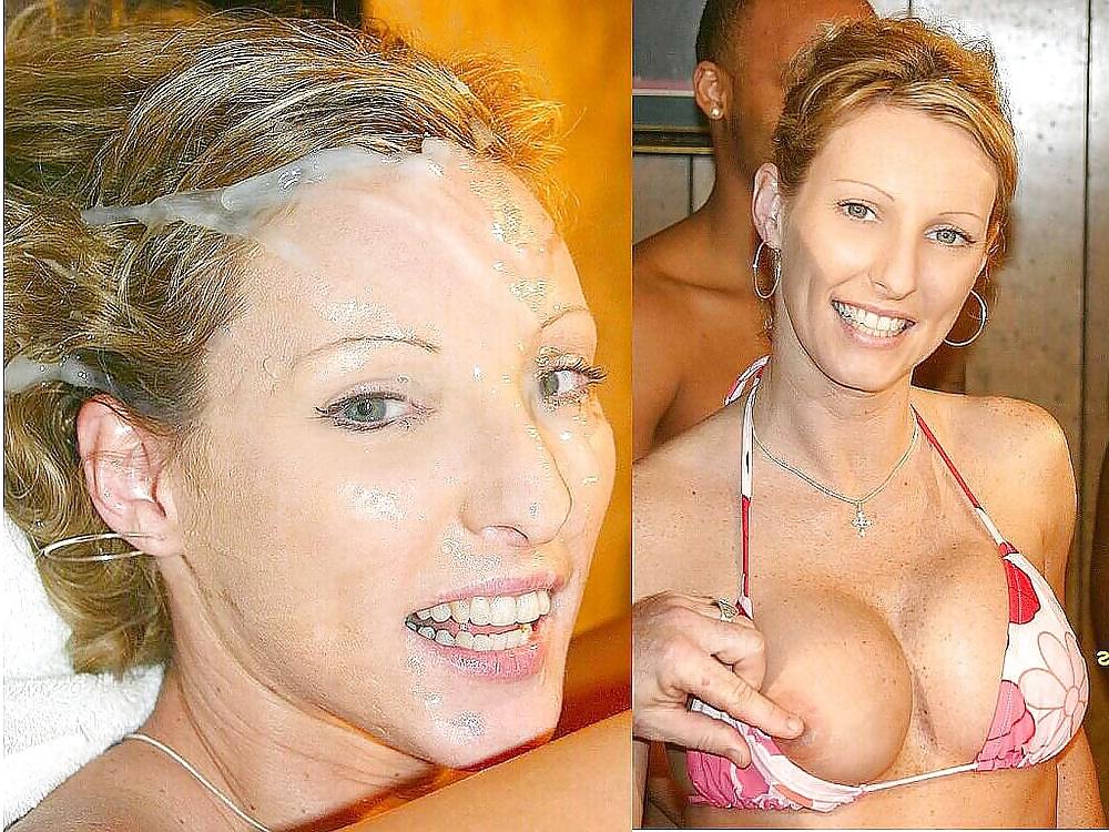 25P Before and after