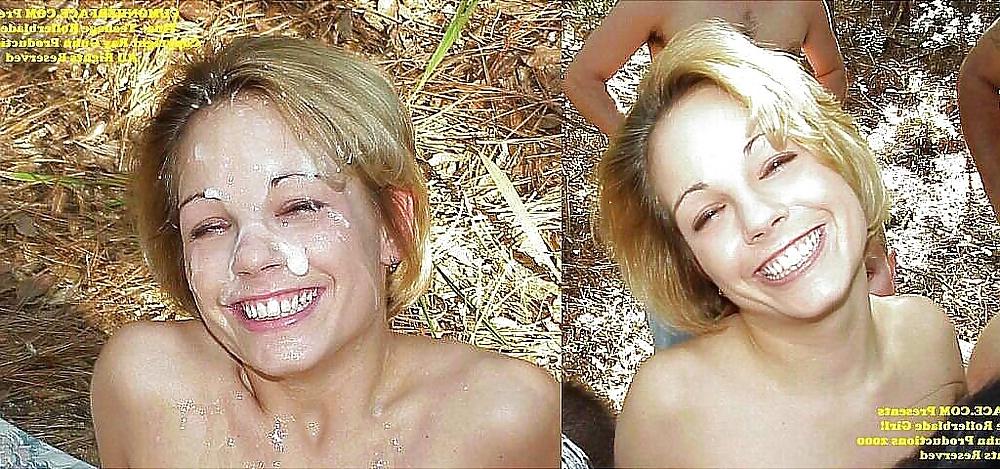 25P Before and after