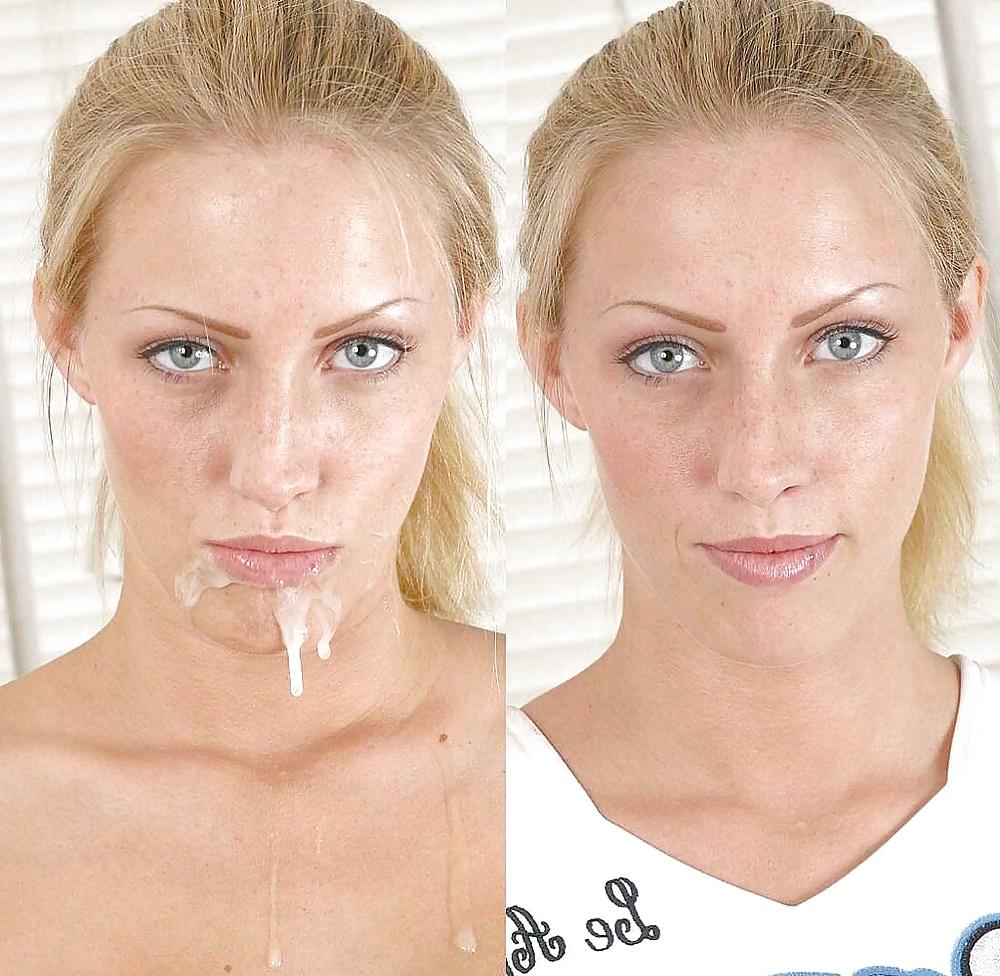 25P Before and after