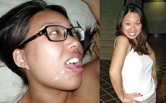 25P Before and after