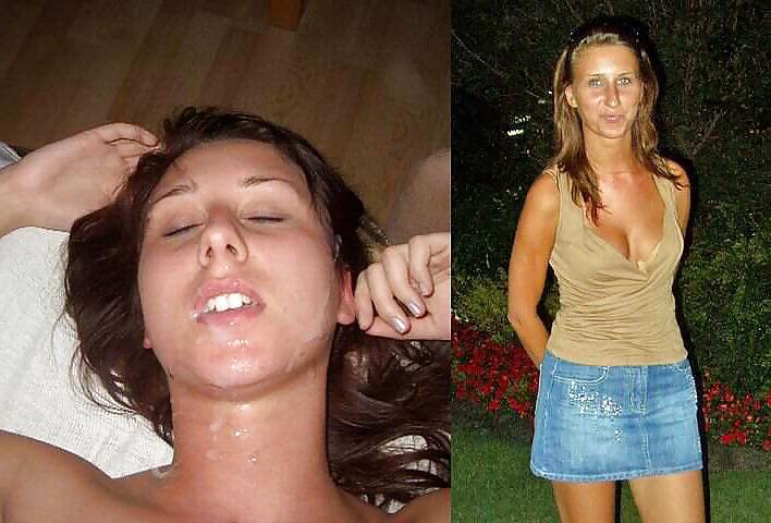 25P Before and after