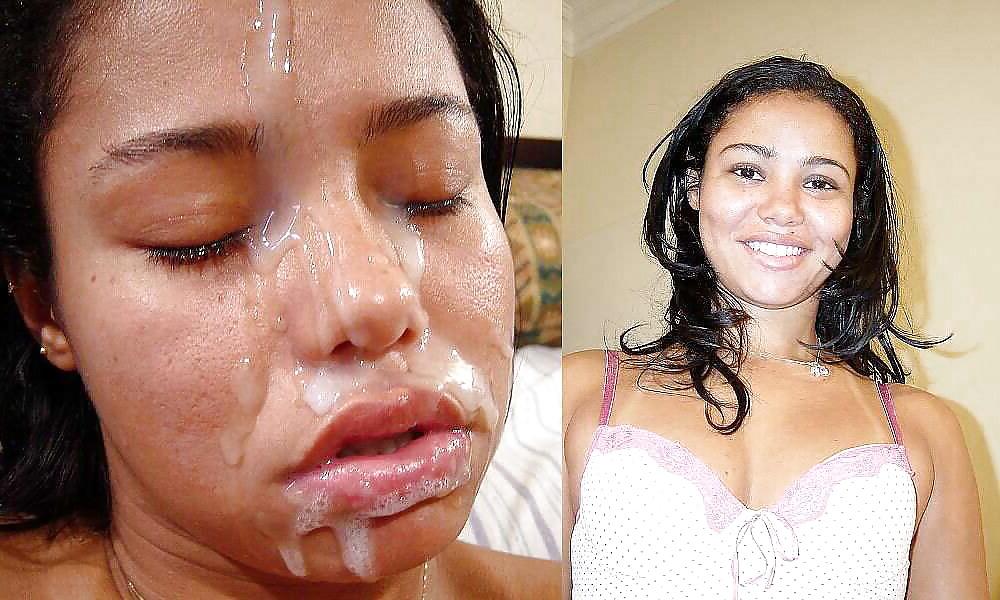 25P Before and after
