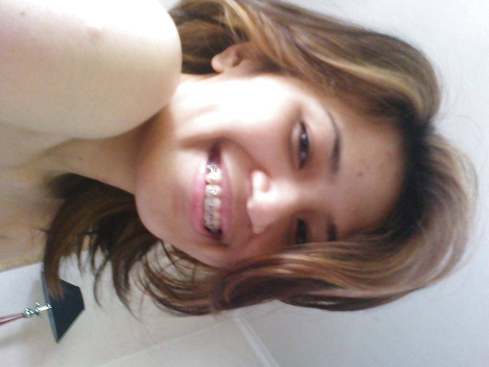 9P Malay girl with braces