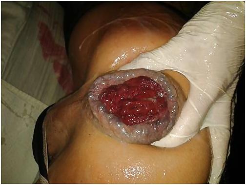 8P It's a very nice male cunt