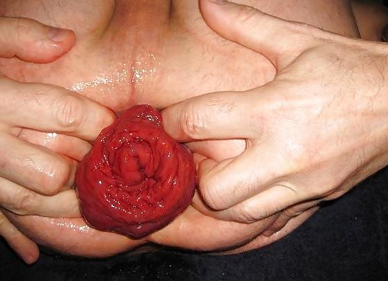 6P Prolapse male cunt