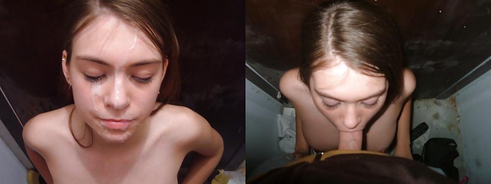 8P Teens before and after