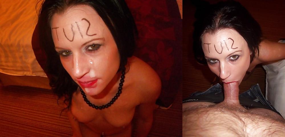 8P Teens before and after