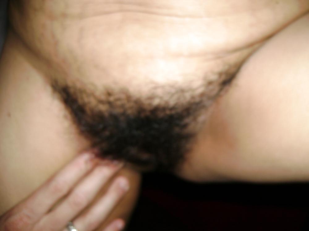 10P Hairy mexican