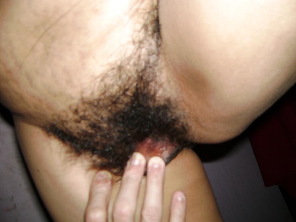 10P Hairy mexican