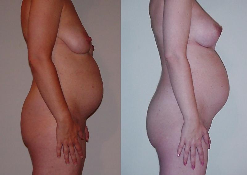 15P Lovely pregnant amateur women