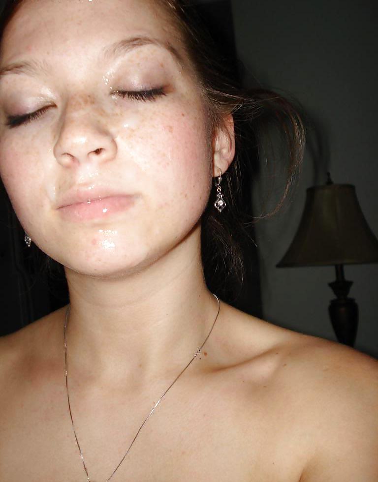 10P Hot Facials