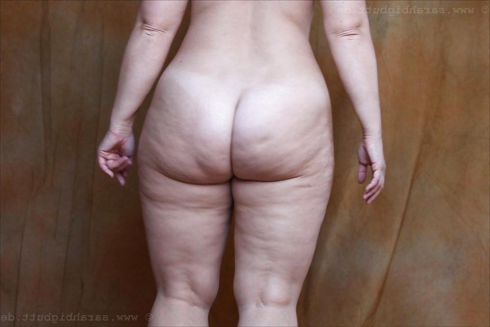 25P Thick, White and Cellulite 76