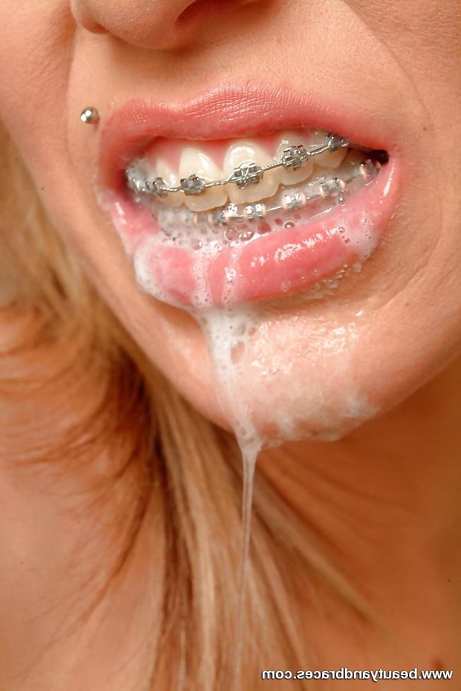 23P Cum on braces (Camaster)
