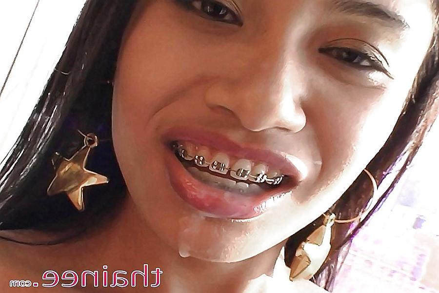 23P Cum on braces (Camaster)