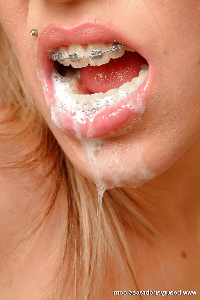 23P Cum on braces (Camaster)