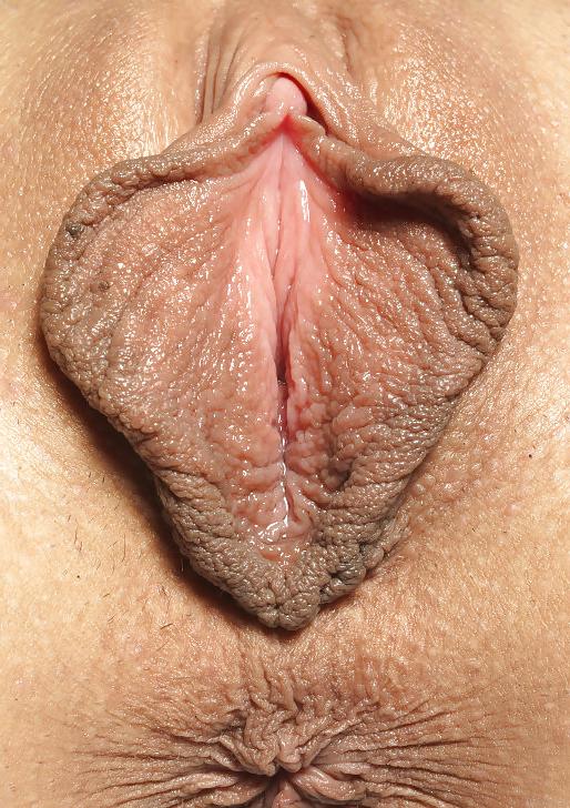 25P Große Schamlippen – Große Schamlippen 3 BoB