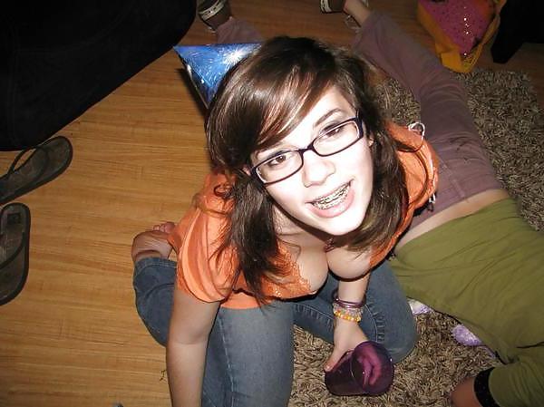 6P Braces
