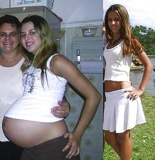 8P Pregnant before and after