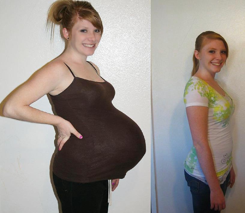 8P Pregnant before and after