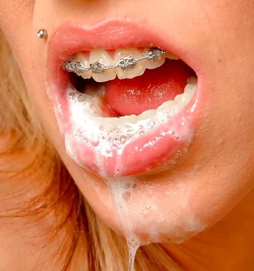 7P Cum On My Braces Please