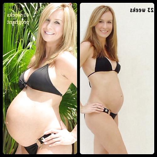 25P Pregnant Women
