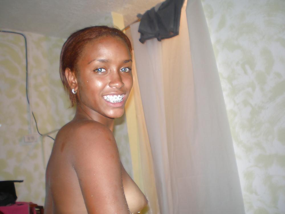 18P Cute Tenn Girlfriend in Braces