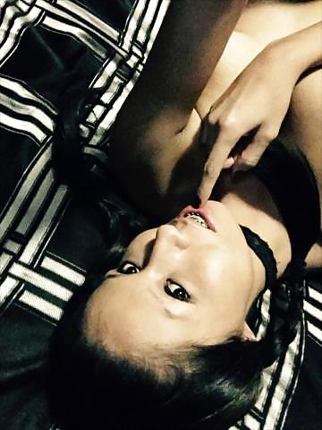 25P Native girl with braces