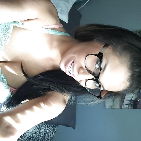 25P Native girl with braces