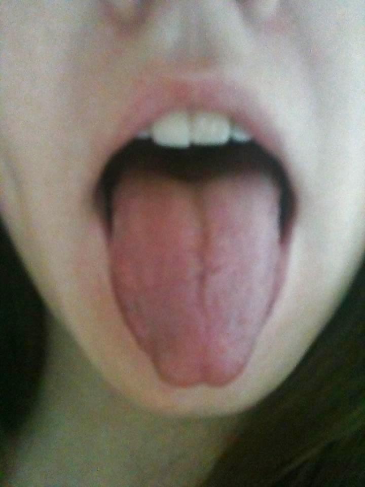 25P Tongue - For facial EJAC #1