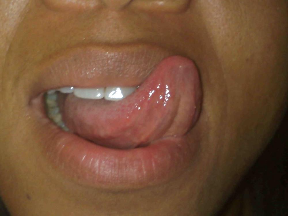 25P Tongue - For facial EJAC #1