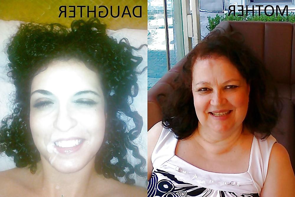 6P Before and After Facials