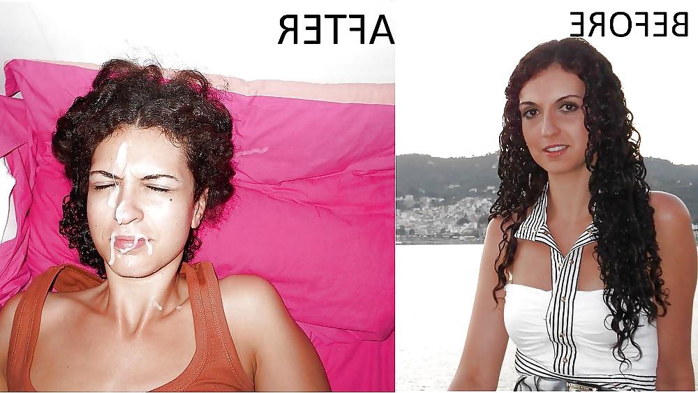 6P Before and After Facials