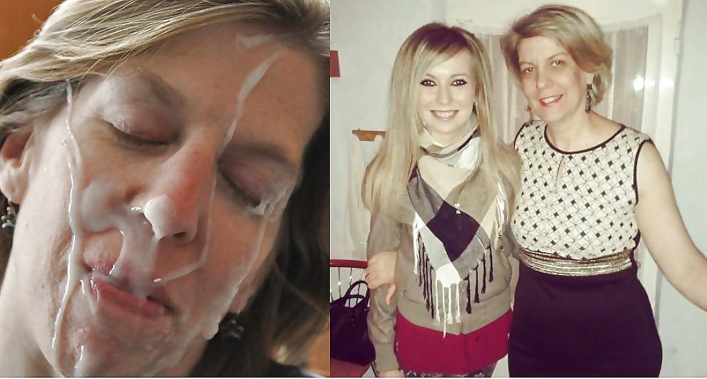 6P Before and After Facials