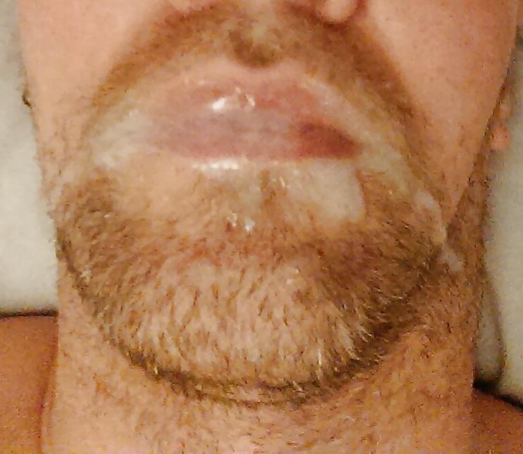 25P Self facials