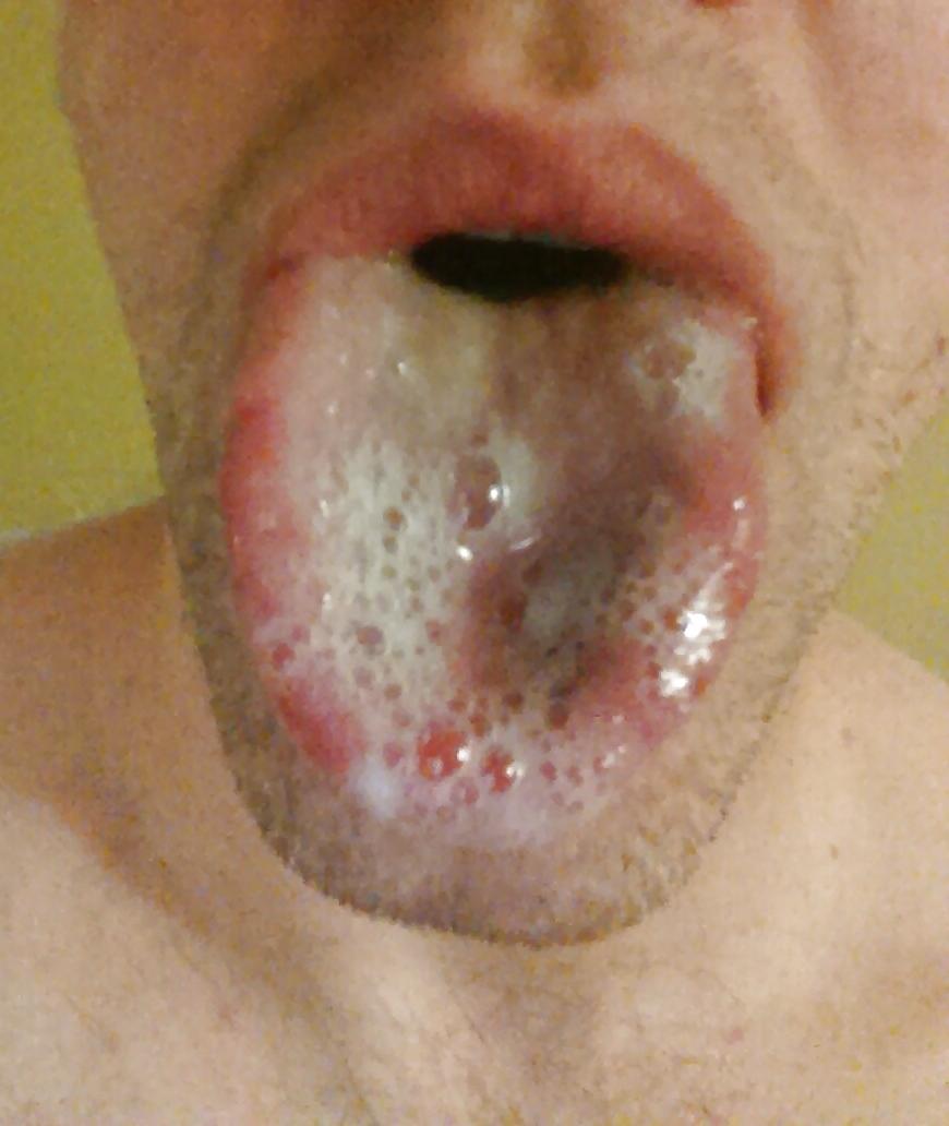 25P Self facials