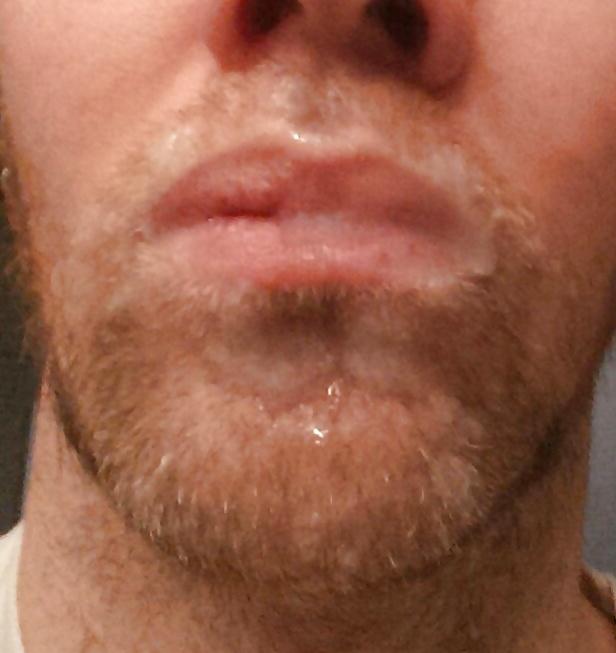25P Self facials