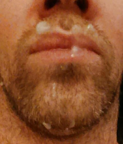 25P Self facials