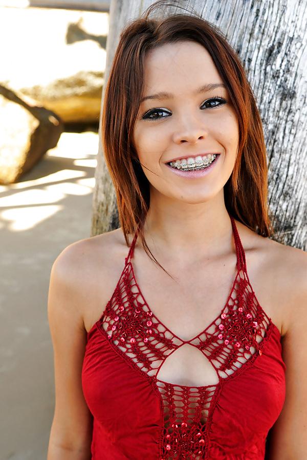 13P Braces