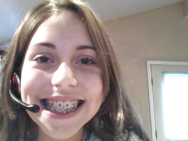 13P Braces