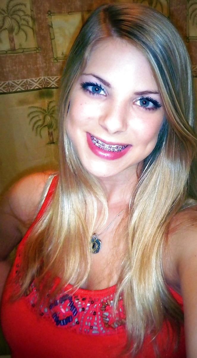 13P Braces