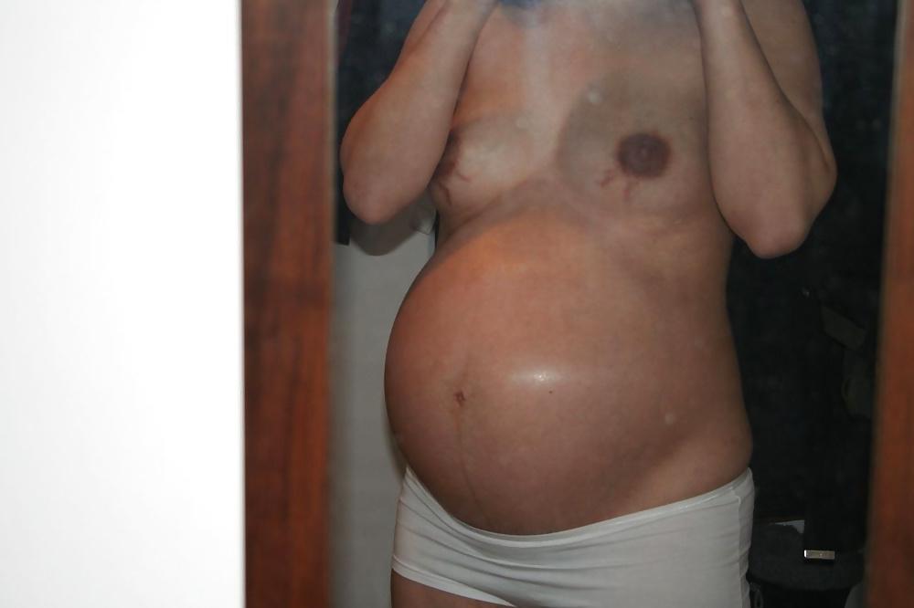 25P Hairy pregnant