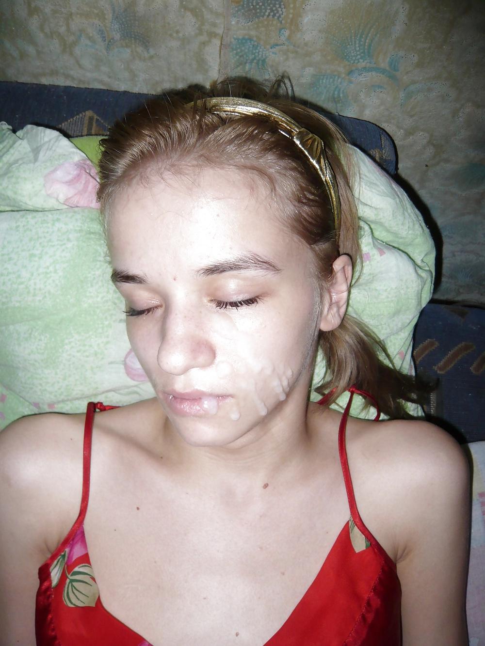 25P Mpl75 amateur facials