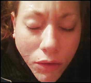 19P Facials