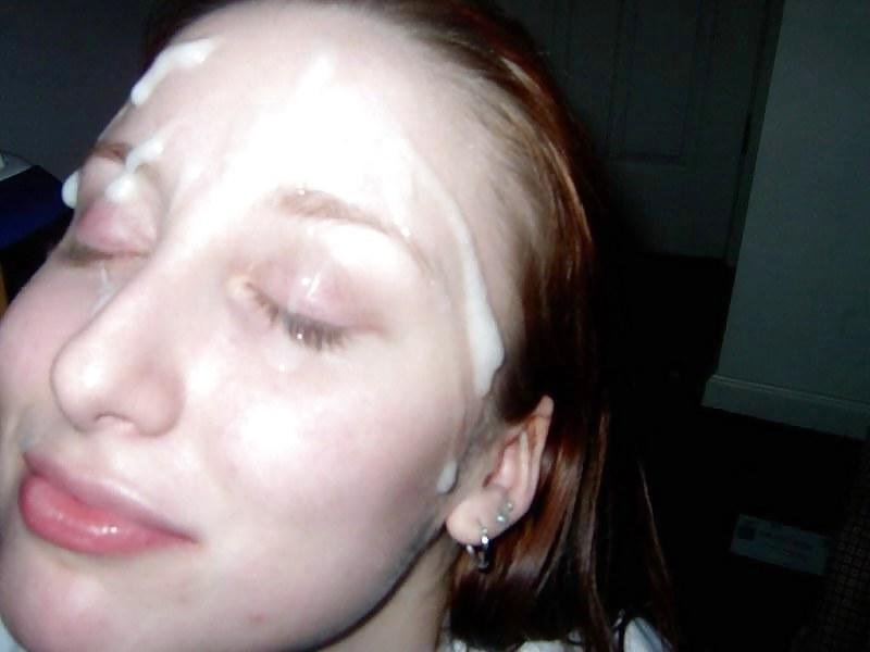 5P Hot facials