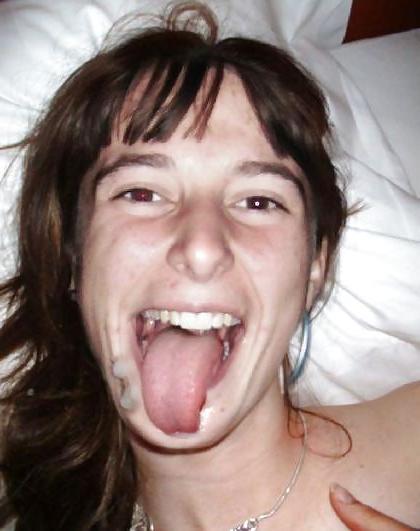 25P Facial Pics