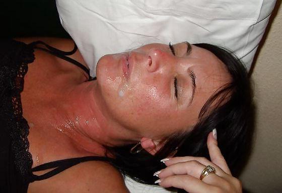 25P Facial Pics