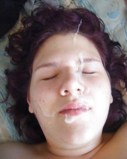25P Facial Pics