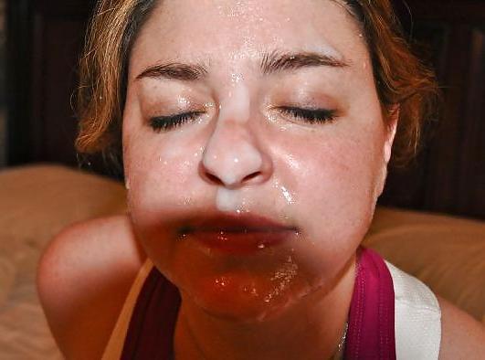 25P Facial Pics