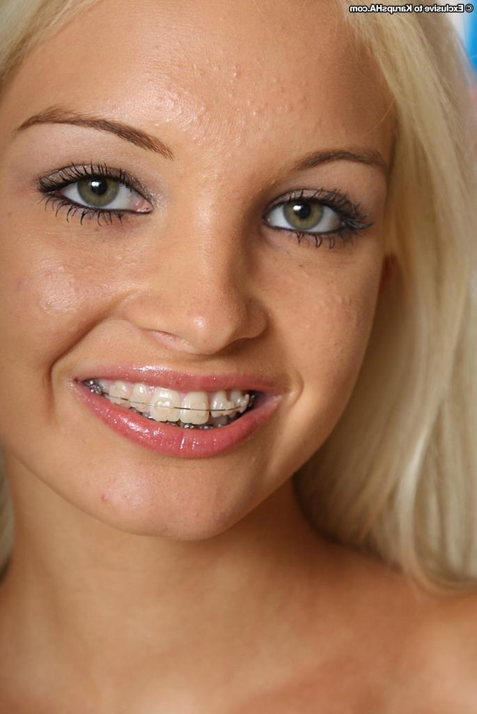 16P Barley legal hottie Franziska modelling solo in braces and panties