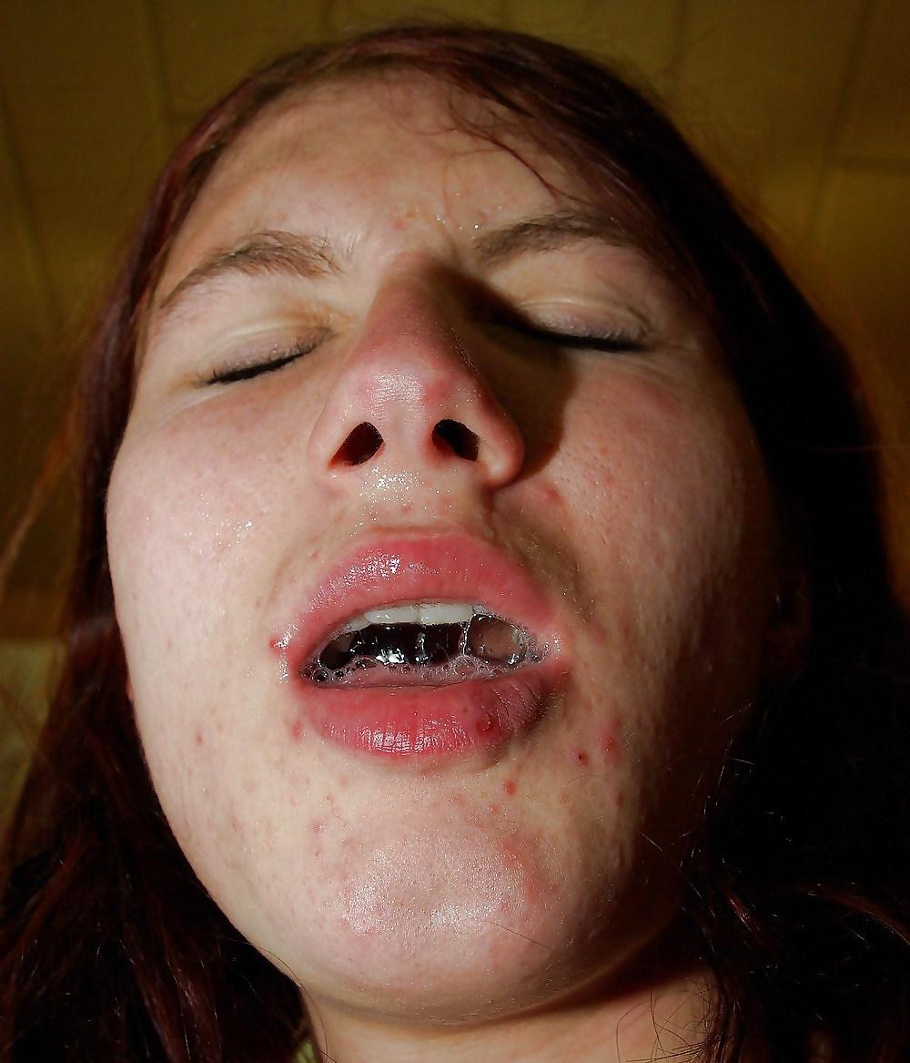 20P Hot facials